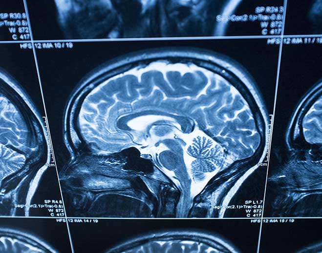 neurology-brain-scan-mri
